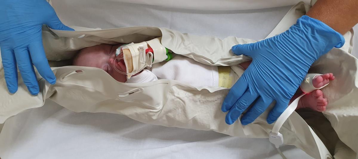 El Hospital General de Elche realiza resonancias magnéticas a bebés sin necesidad de sedarles