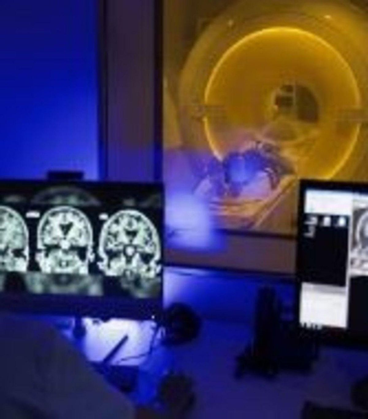 Encarant l’Alzheimer Encarant l’Alzheimer