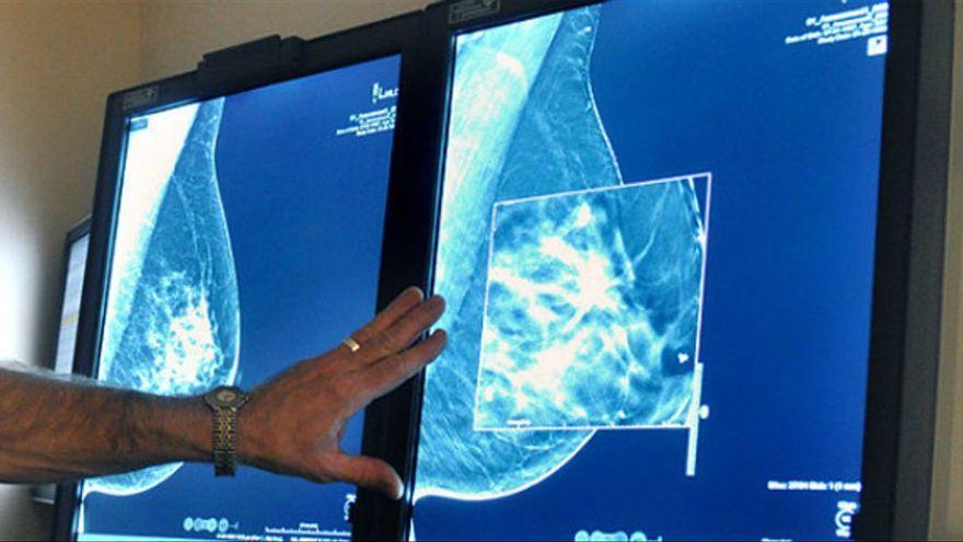 Un metge observa la mamografia d’una pacient
