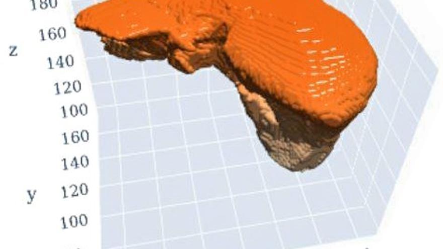 El Chuvi trabaja en una herramienta para reconstruir hígados en 3D