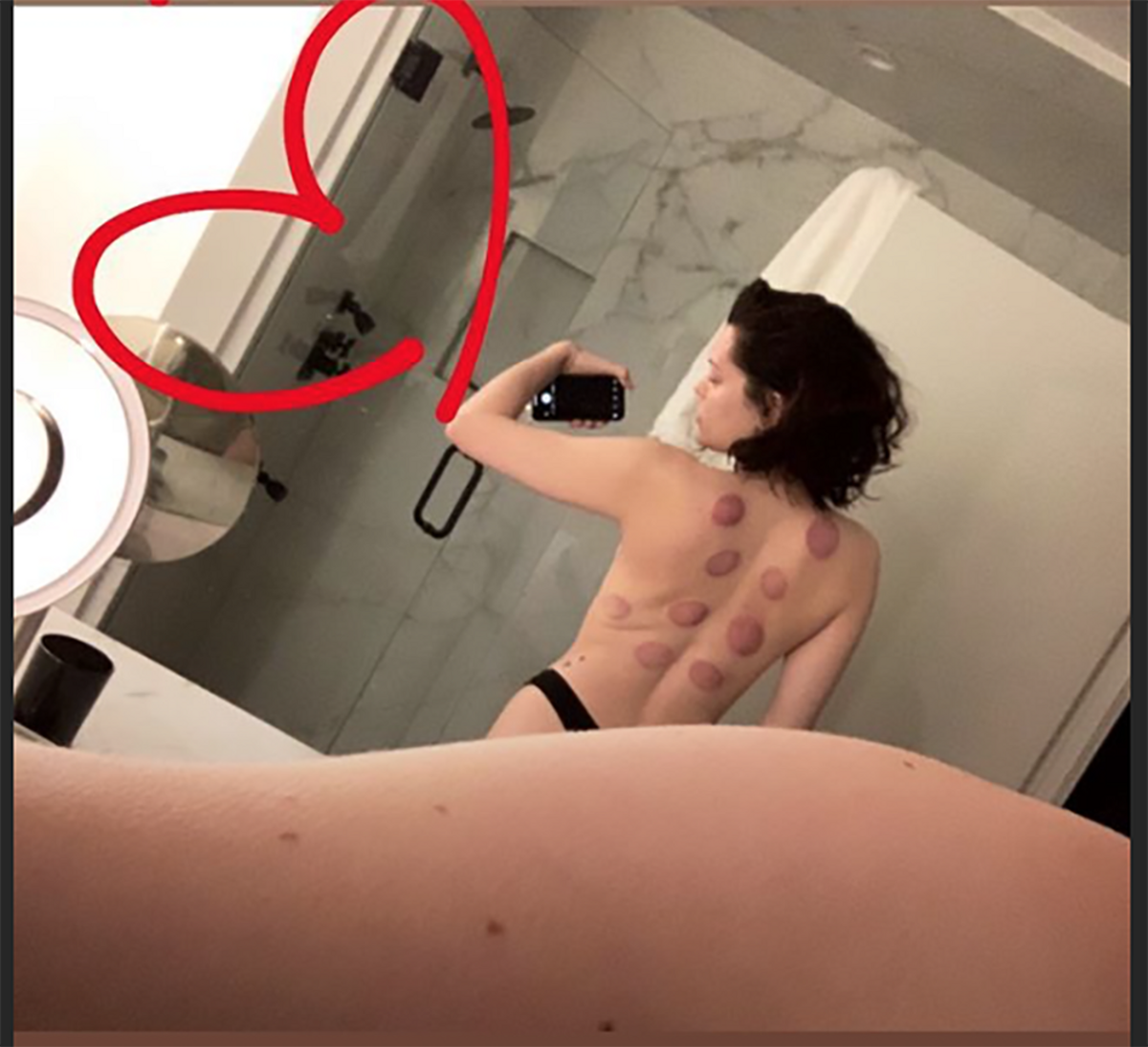 Jessie J con marcas en la espalda