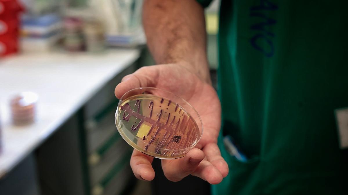 El microbiólogo del Hospital de La Candelaria, Diego Martínez muestra una placa de petri con un cultivo de bacterias resistentes