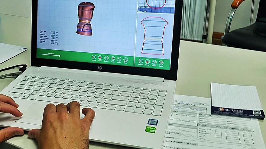 Modelo de corsé 3D que se ha implantado a un niño andaluz de 13 años.