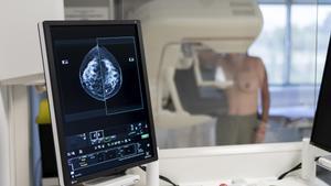 Una técnica especialista en radiodiagnóstico realiza una mamografía a una mujer que participa en el programa de detección precoz del cáncer de mama en el ICO