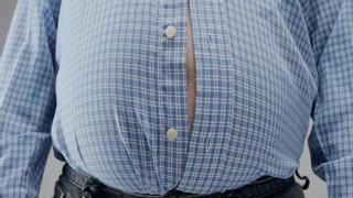 El coste de ser obeso en España: una enfermedad crónica, sin tratamiento ni diagnóstico