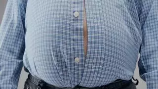 El coste de ser obeso en España: una enfermedad crónica, sin tratamiento "adecuado" e infradiagnosticada