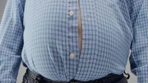 El coste de ser obeso en España: una enfermedad crónica, infradiagnosticada y sin tratamiento “adecuado”