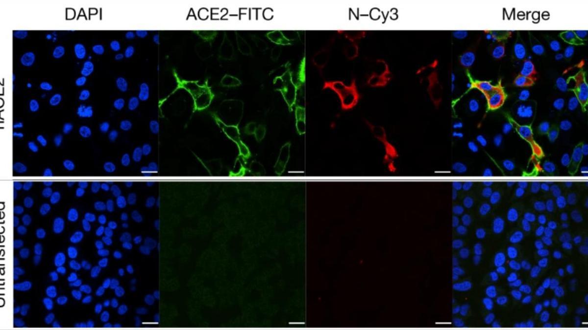 Células susceptibles a la infección por SARS-CoV-2.