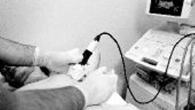 La terapia hormonal provoca unos 16.000 cánceres cada año