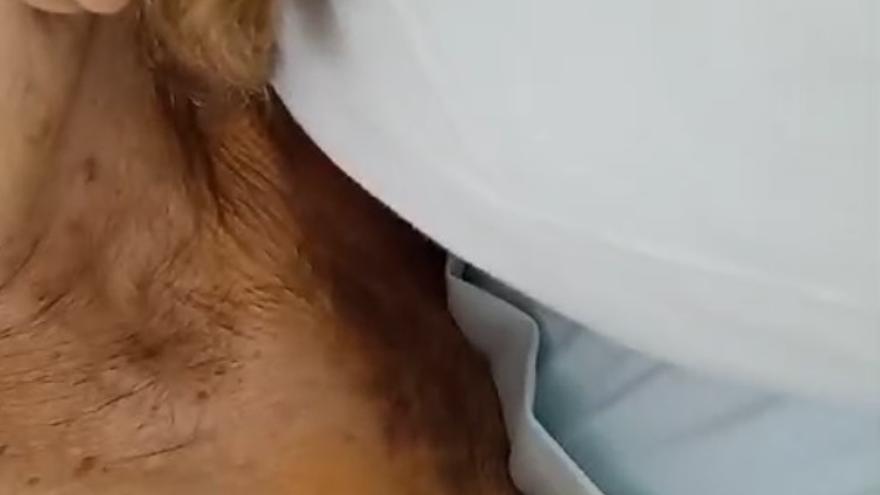 Golpean brutalmente a una octogenaria de Murcia para robarle una cadena de oro: &quot;La mataban&quot;