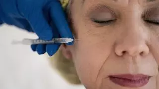 ¿Qué tratamientos pueden mejorar nuestra apariencia facial sin pasar por quirófano?
