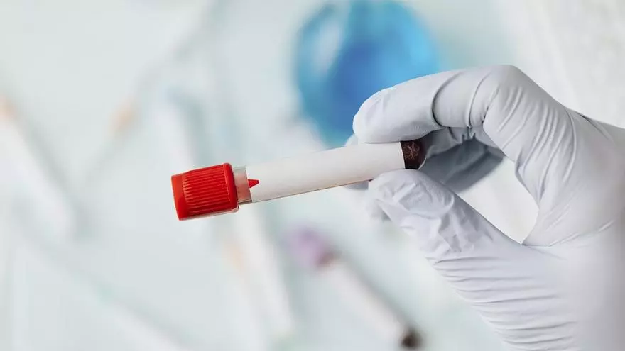 En una analítica, ¿qué significa tener los triglicéridos altos? ¿Qué hacer para bajarlos?