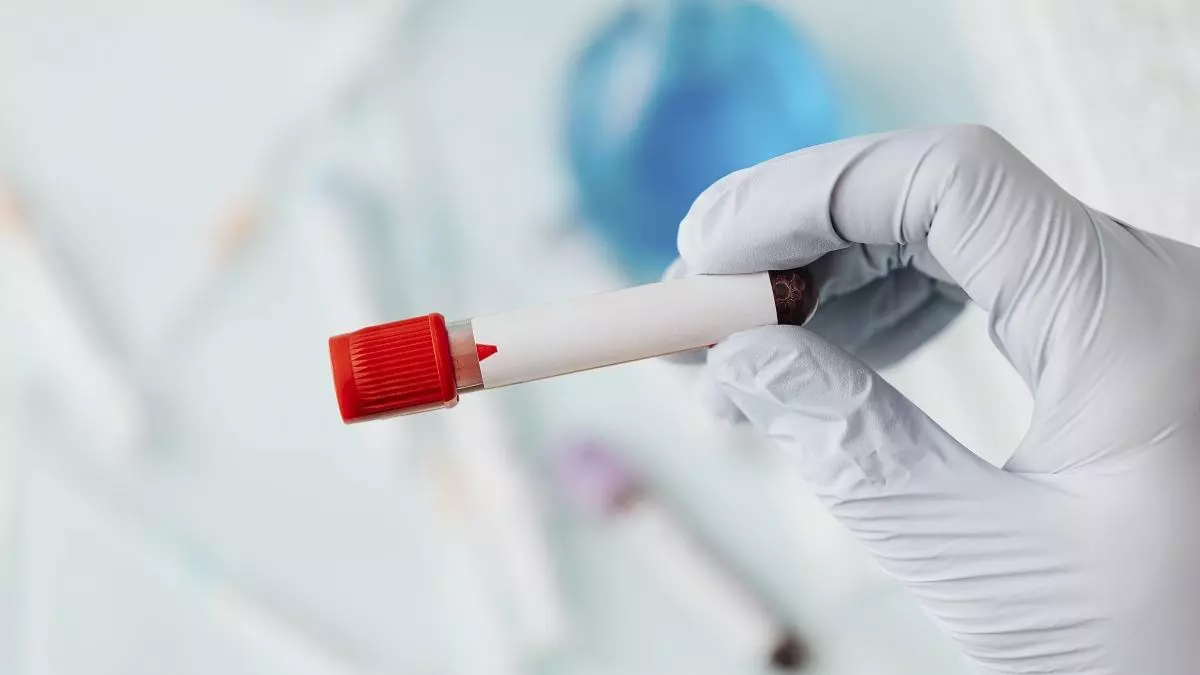 En una analítica, ¿qué significa tener los triglicéridos altos? ¿Qué hacer para bajarlos?