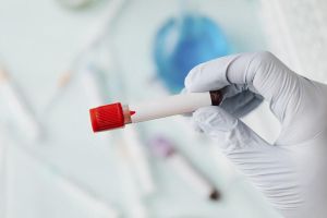 En una analítica, ¿qué significa tener los triglicéridos altos? ¿Qué hacer para bajarlos?