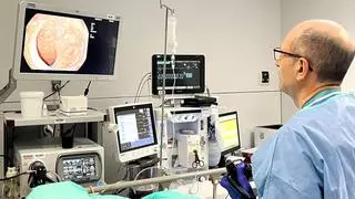 El test de sangre en heces es tan eficaz como la colonoscopia para detectar cáncer de colon, según el mayor estudio hasta la fecha