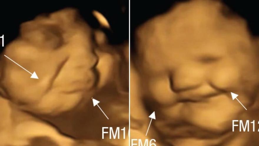 Els nadons reaccionen al gust ja dins de l’úter: somriuen amb la pastanaga i ploren per la col