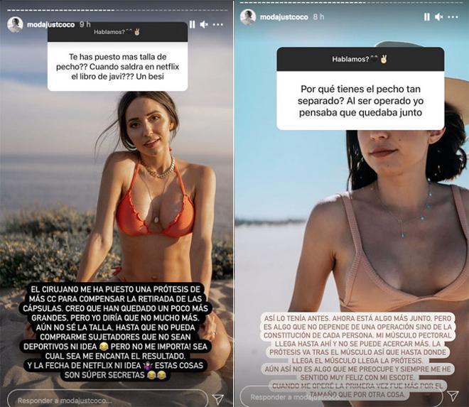 JustCoco (Verónica Díaz) responde en Instagram sobre su operación de pecho