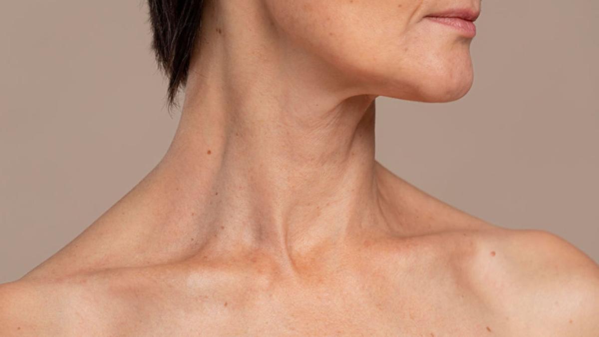 Como eliminar la flacidez y las arrugas del cuello
