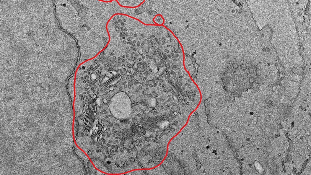 La capacidad de la IA para diagnosticar errores en protocolos y sugerir ajustes precisos promete acelerar el desarrollo de vacunas y la comprensión de patógenos emergentes.