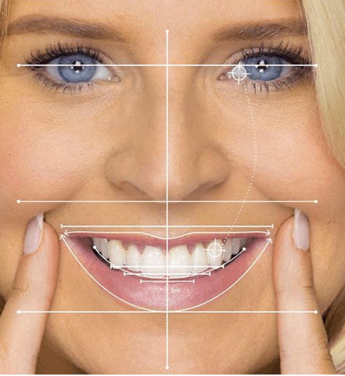 Para conseguir una estética dental se analiza el color, la forma y el tamaño del diente.