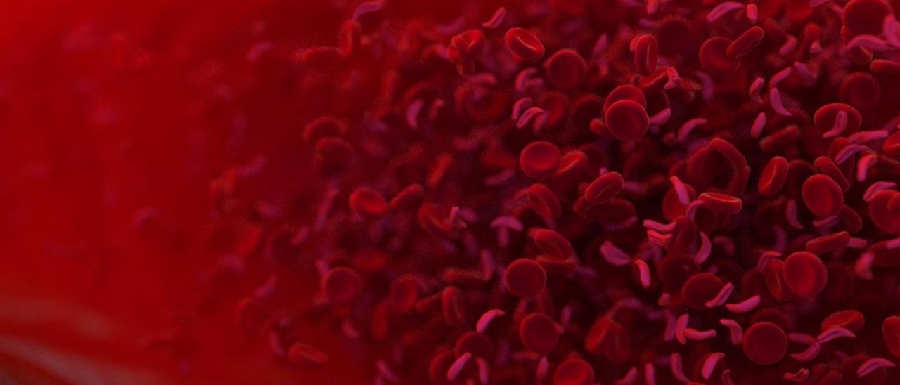 Qué es la talasemia y cómo se puede tratar este raro trastorno hereditario de la sangre
