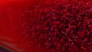 Anemia en la sangre en la que algunos de los glóbulos rojos tienen forma de media luna.