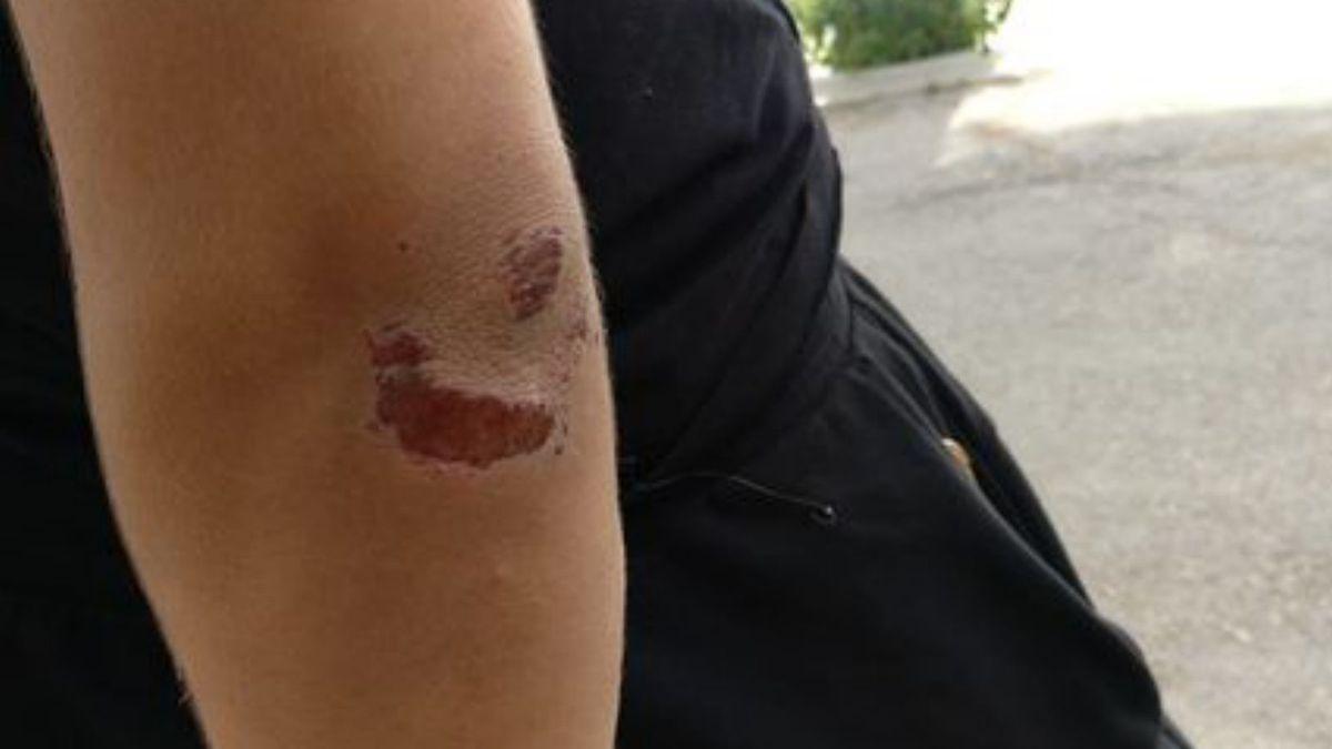 Algunos de los jóvenes que presuntamente atacaron al policía muestran su lesiones.