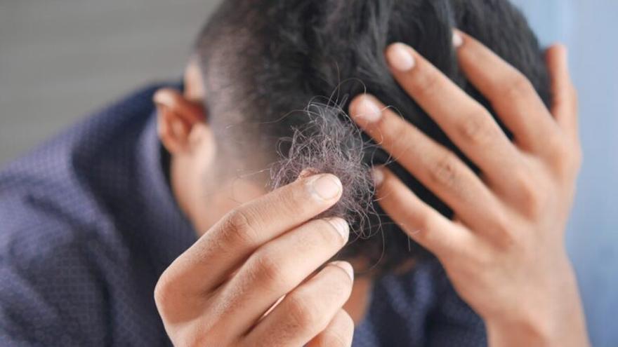 El producto de Mercadona para combatir la alopecia en hombres: no llega a 7 euros y frena la caída del cabello