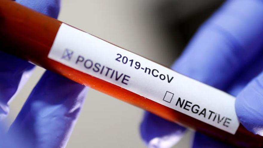 Tres nuevos muertos con coronavirus elevan a 16 los fallecidos en Baleares