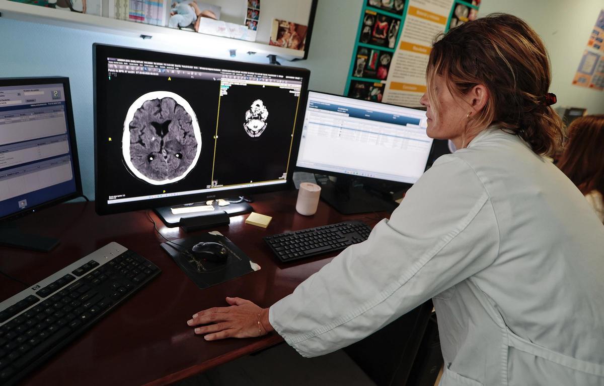 Mónica Fernández del Castillo, coordinadora de Radiología de Urgencias de La Candelaria, observa una imagen cerebral.