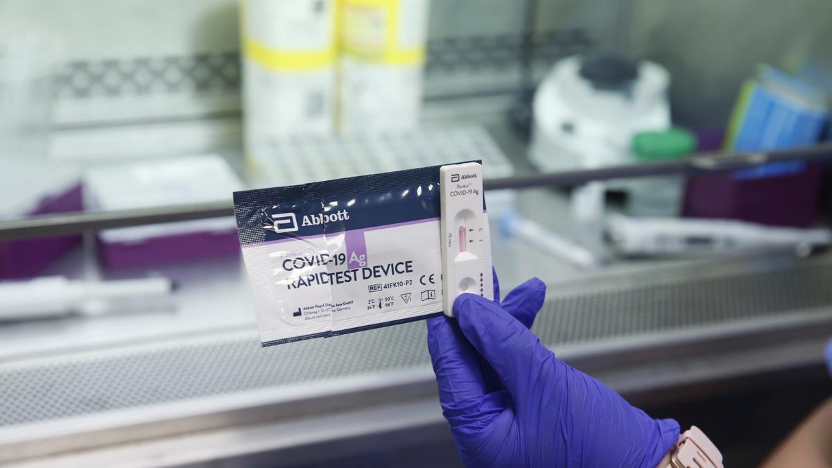 Test de antígenos que serán usados para el diagnóstico rápido del covid