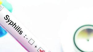 La falta d’educació sexual, motiu principal de l’augment d’ITS entre les dones