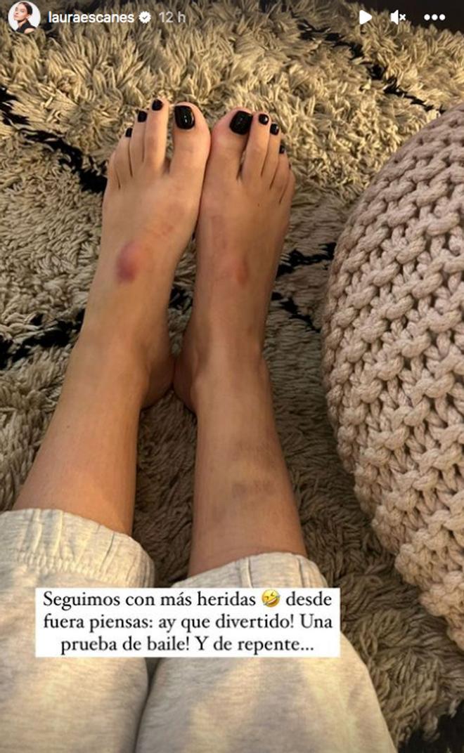 Los pies con heridas de Laura Escanes