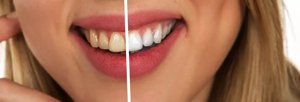 El cuidado de los dientes es muy evidente
