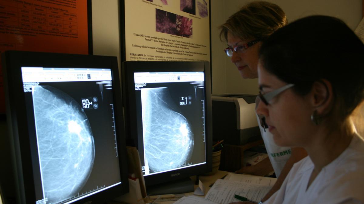 Dos profesionales observan una mamografía en los monitores.