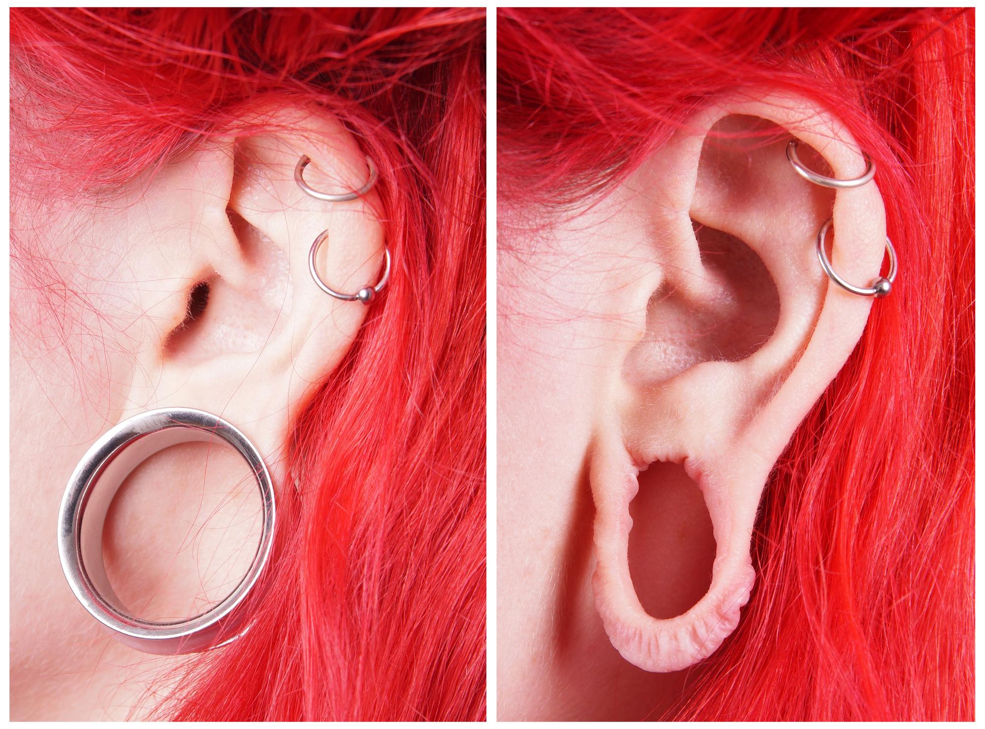 Cómo cerrar una dilatación de oreja - 6 pasos