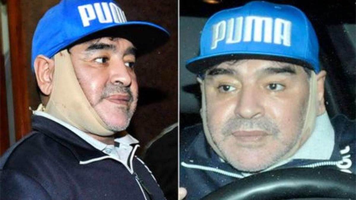 Maradona, con el aparatoso vendaje que lucía tras someterse a una cirugía estética maxilofacial