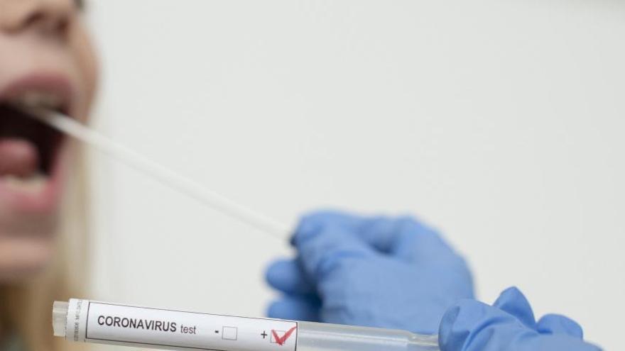 Arriben a Catalunya 25.000 testos ràpids per al coronavirus