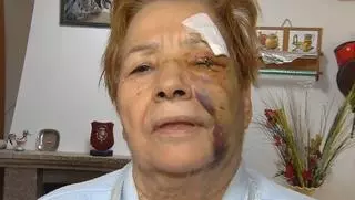 Absuelven a los dueños de los perros que atacaron a una vecina en el concello ourensano de Muíños