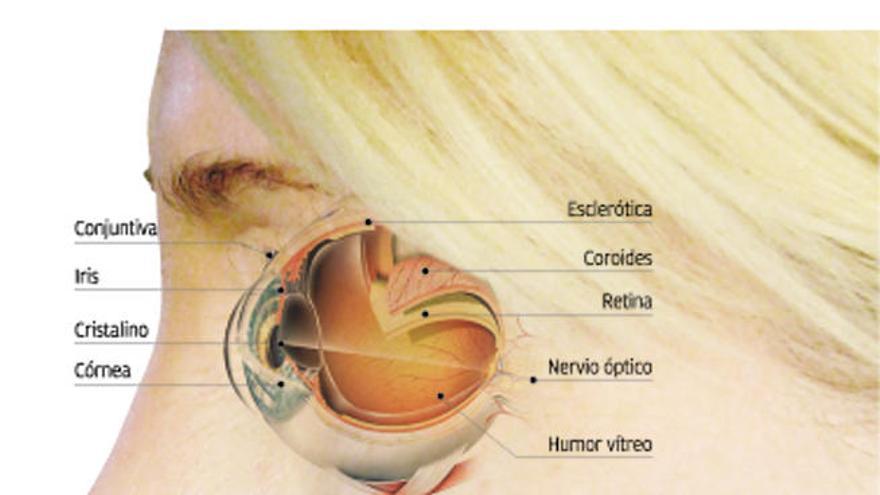 Glaucoma, el ladrón sigiloso de la visión