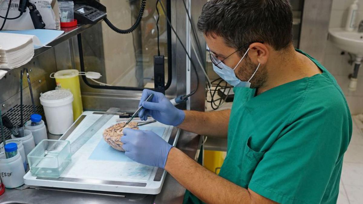 Un investigador manipula uno de los cerebros.