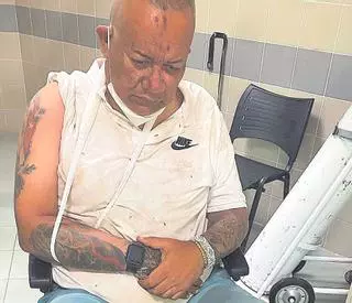 El cantante Moi González sufre un accidente en una acera ‘mal construida’