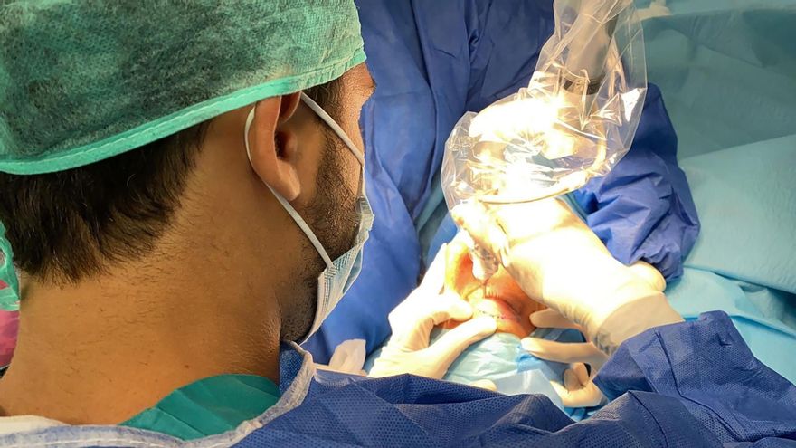 Quirónsalud Málaga incorpora un láser oftalmológico para blefaroplastia sin cirugía