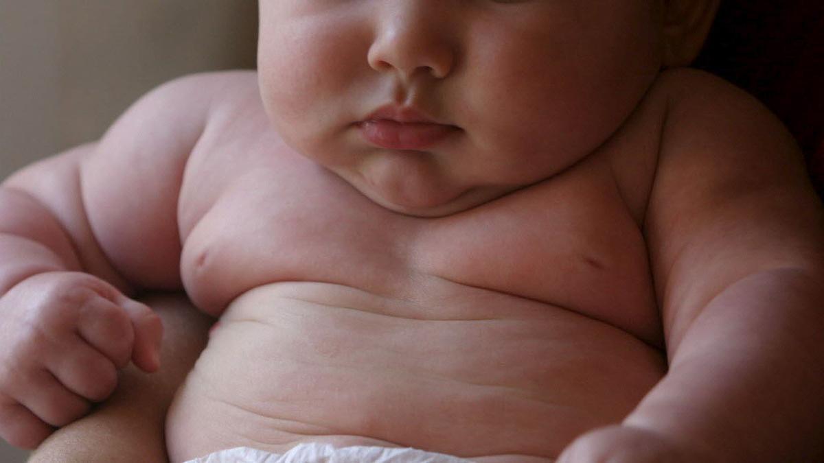 Un niño con exceso de peso.
