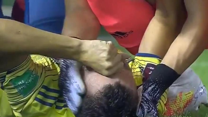 Vídeo espeluznante: Santiago Arias termina con el tobillo colgando