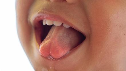 ¿Por qué tener saliva suficiente es esencial para la salud de la boca y dientes?