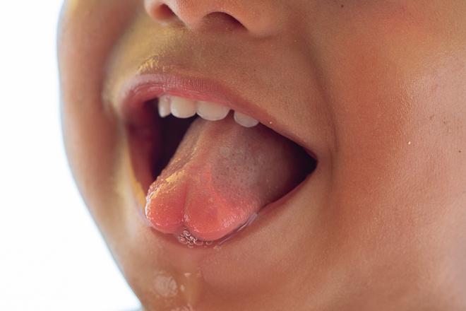 ¿Por qué tener saliva suficiente es esencial para la salud de la boca y dientes?