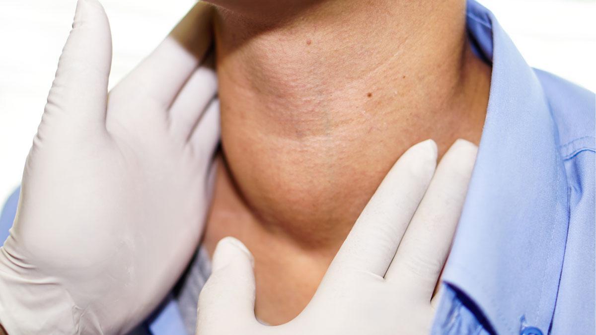 Un médico palpa el cuello a un paciente. Un médico palpa el cuello a un paciente.