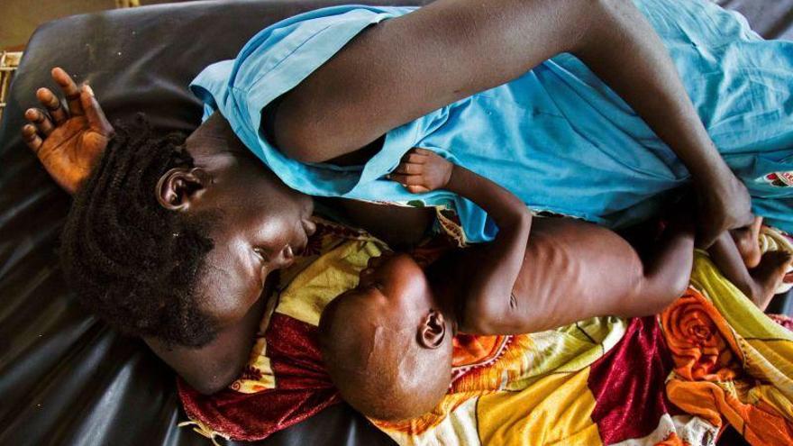 SOS de la OMS para acabar con la malnutrición en África en el 2030