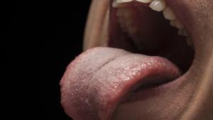 El color de tu lengua puede avisarte si tienes cáncer o diabetes, según Harvard